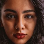 Questions sur la toxine botulique : Les infiltrations de Toxine Botulique sont-elles douloureuses ?