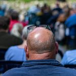 Solutions contre la calvitie pour homme et femme