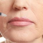 injection acide hyalurobique chirurgie