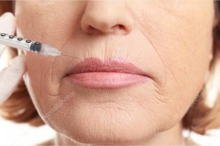 injection acide hyalurobique chirurgie
