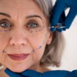 Injections pour le visage avec acide hyaluronique en médecine esthétique
