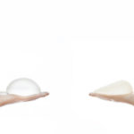 Augmentation mammaire haut de gamme et sur mesure par le Dr Smarrito