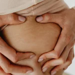 Que faire contre les Vergetures en médecine esthétique ?